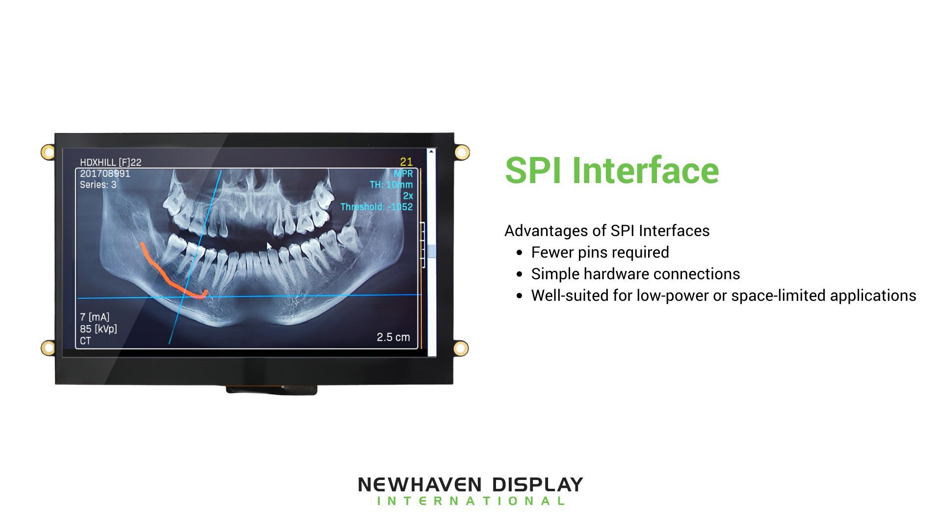 SPI interface